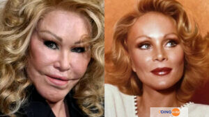 Jocelyn Wildenstein : La Mondaine De 82 Ans Révèle Son Vrai Visage Avant Sa Chirurgie Plastique