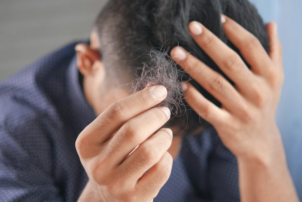 Début de calvitie : signes, causes et que faire dès les premiers cheveux qui tombent